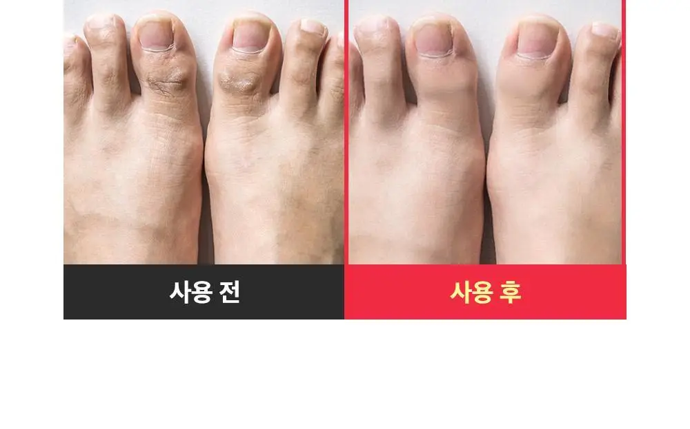 [데일리풋케어/맨들맨들아기발] 성분에디터 시어버터 베이비 풋 스틱 20g 2종 택 1 상세페이지 33